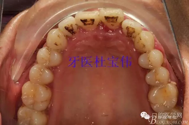 640.webp (14).jpg 640.webp (14).jpg