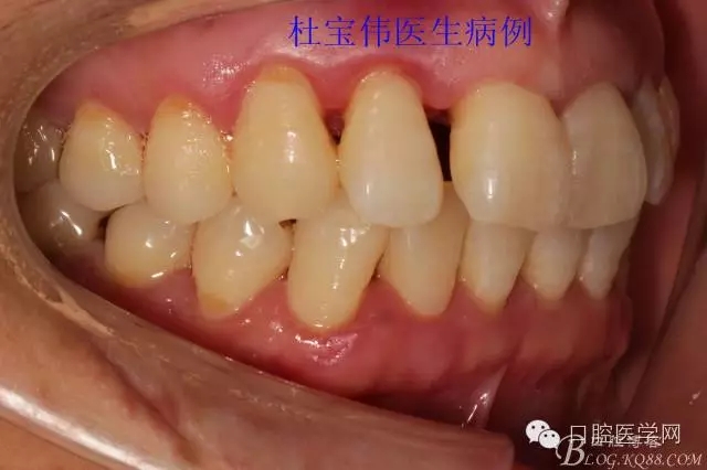 640.webp (16).jpg 640.webp (16).jpg