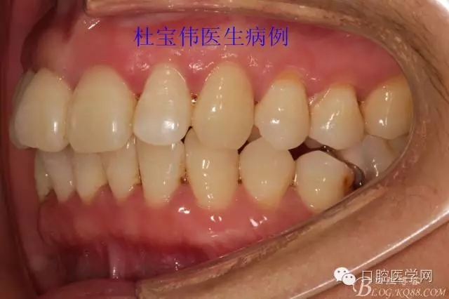 640.webp (17).jpg 640.webp (17).jpg