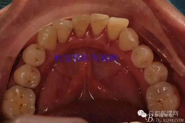 640.webp (19).jpg 640.webp (19).jpg