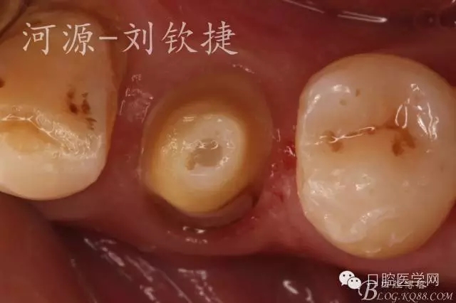 640.webp (3).jpg 640.webp (3).jpg