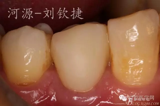 640.webp (12).jpg 640.webp (12).jpg