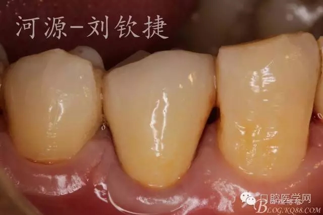 640.webp (19).jpg 640.webp (19).jpg