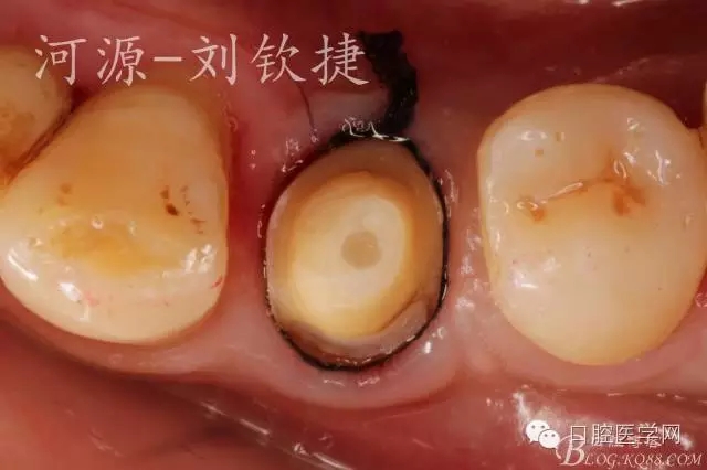 640.webp (23).jpg 640.webp (23).jpg