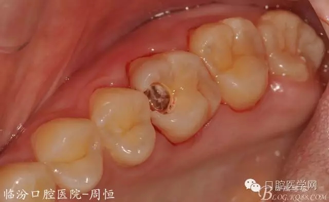 640.webp (2).jpg 640.webp (2).jpg