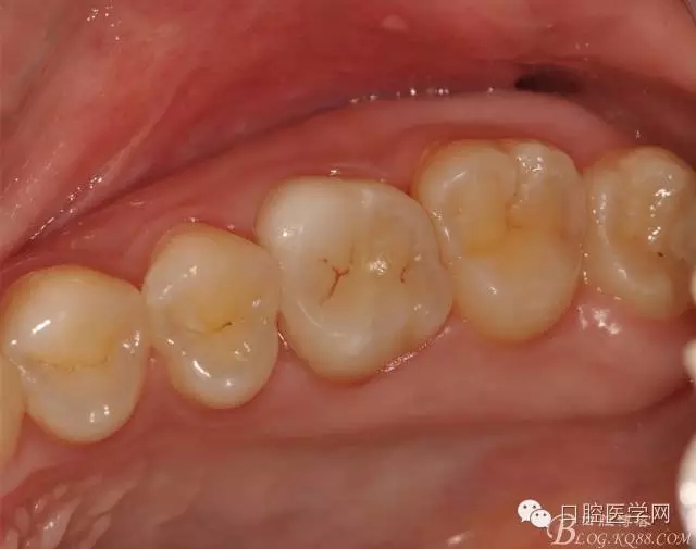 640.webp (11).jpg 640.webp (11).jpg