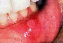 0.webp.jpg 0.webp.jpg