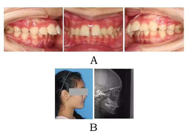 640.webp (1).jpg 640.webp (1).jpg