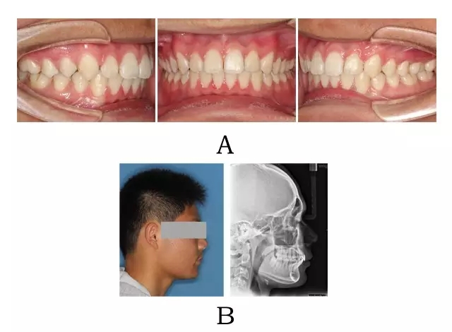 640.webp (3).jpg 640.webp (3).jpg