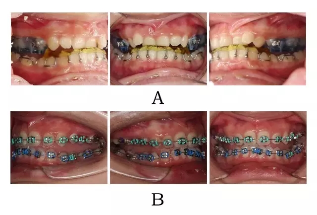 640.webp (5).jpg 640.webp (5).jpg