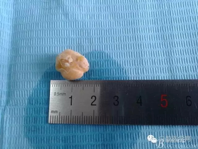 640.webp.jpg 640.webp.jpg