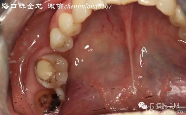 640.webp.jpg 640.webp.jpg