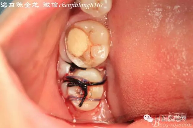 640.webp (5).jpg 640.webp (5).jpg