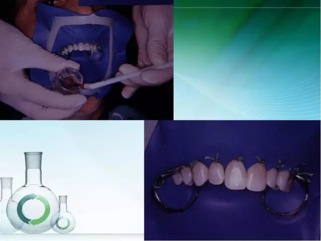 根管治療并發(fā)癥及處理 根管治療并發(fā)癥及處理