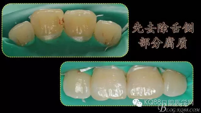 640.webp (3).jpg 640.webp (3).jpg