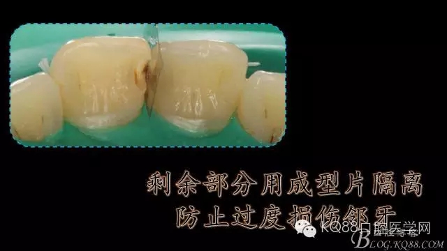 640.webp (4).jpg 640.webp (4).jpg