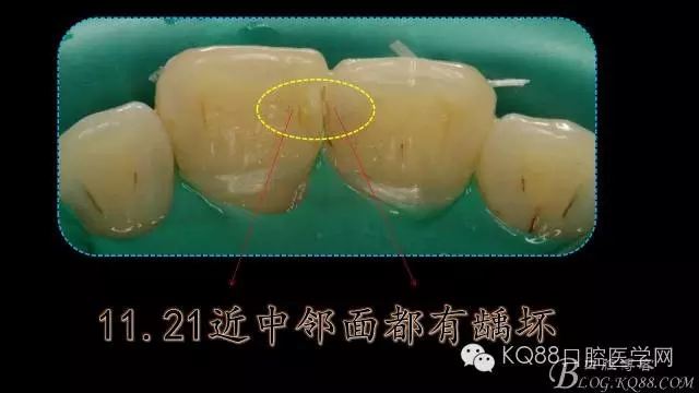 640.webp (5).jpg 640.webp (5).jpg