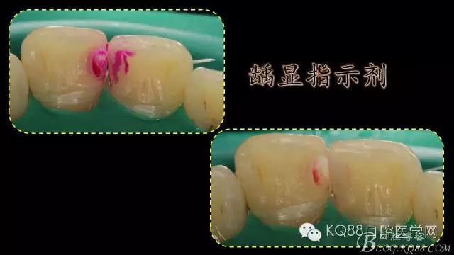 640.webp (6).jpg 640.webp (6).jpg