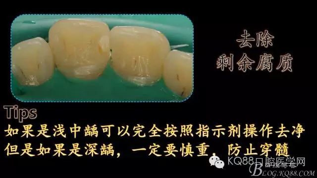 640.webp (7).jpg 640.webp (7).jpg