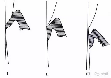 QQ圖片20160825170318.png QQ圖片20160825170318.png