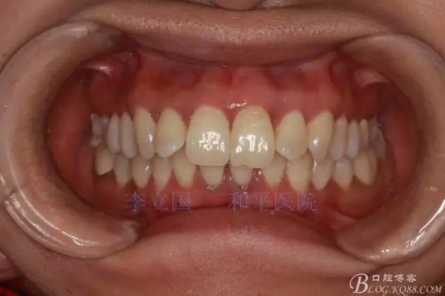 640.webp.jpg 640.webp.jpg