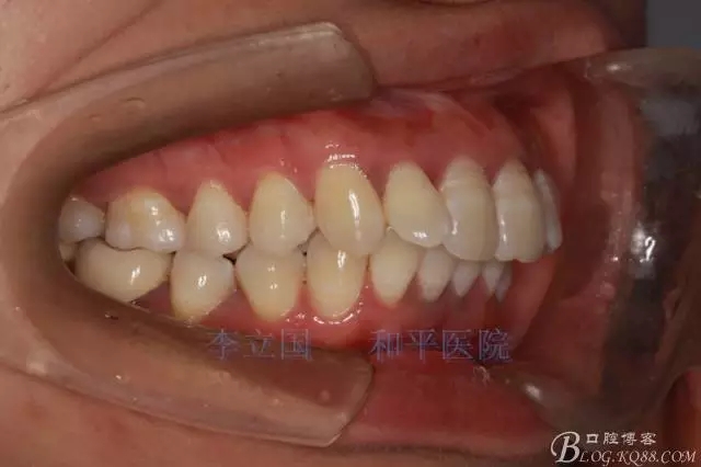 640.webp (1).jpg 640.webp (1).jpg