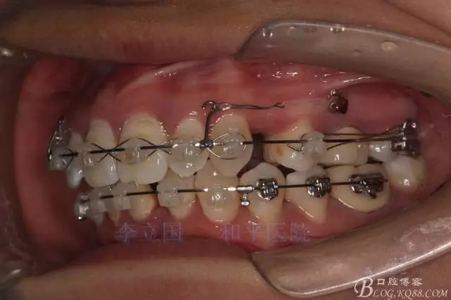 640.webp (6).jpg 640.webp (6).jpg