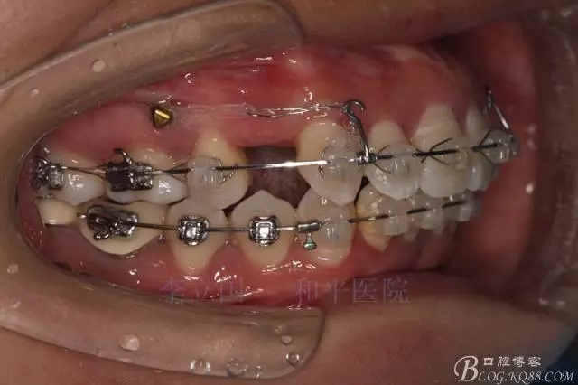 640.webp (7).jpg 640.webp (7).jpg