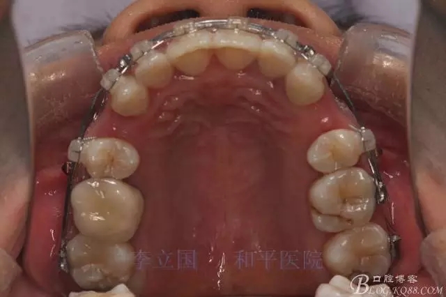 640.webp (8).jpg 640.webp (8).jpg