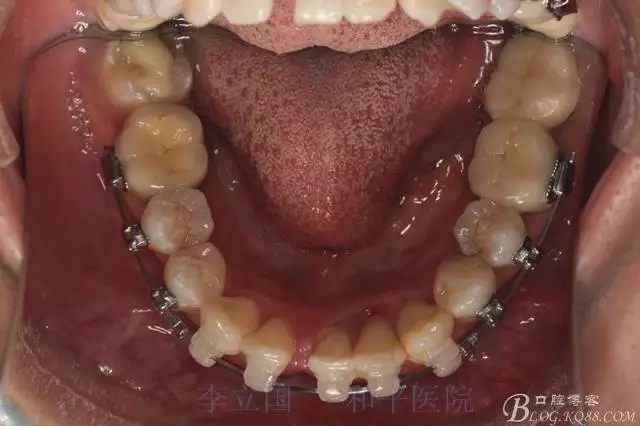 640.webp (9).jpg 640.webp (9).jpg