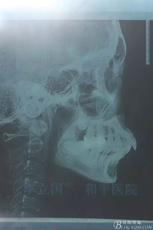 640.webp (11).jpg 640.webp (11).jpg