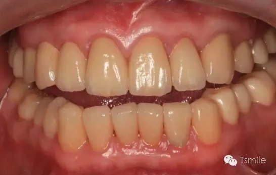 640.webp (3).jpg 640.webp (3).jpg