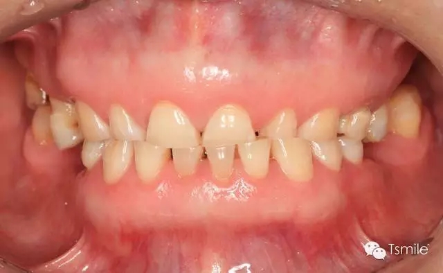 640.webp (5).jpg 640.webp (5).jpg