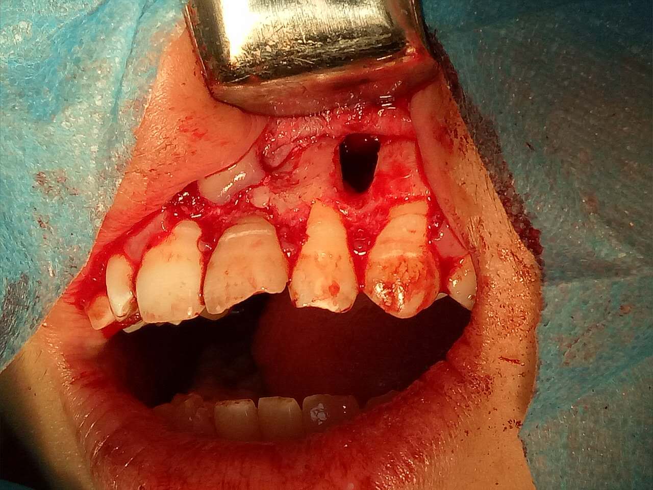 webwxgetmsgimg (2).jpg webwxgetmsgimg (2).jpg