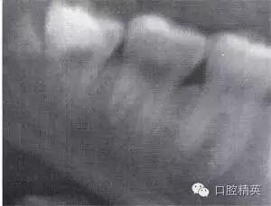 640.webp (9).jpg 640.webp (9).jpg