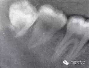 640.webp (10).jpg 640.webp (10).jpg