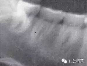 640.webp (12).jpg 640.webp (12).jpg