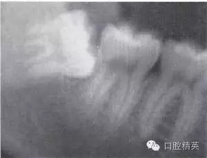 640.webp (14).jpg 640.webp (14).jpg