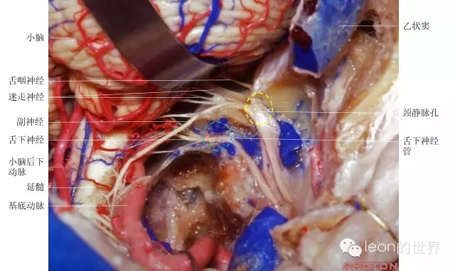 640.webp (8).jpg 640.webp (8).jpg