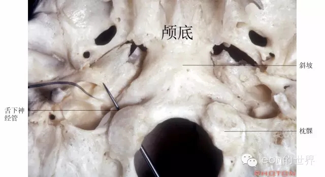 640.webp (14).jpg 640.webp (14).jpg