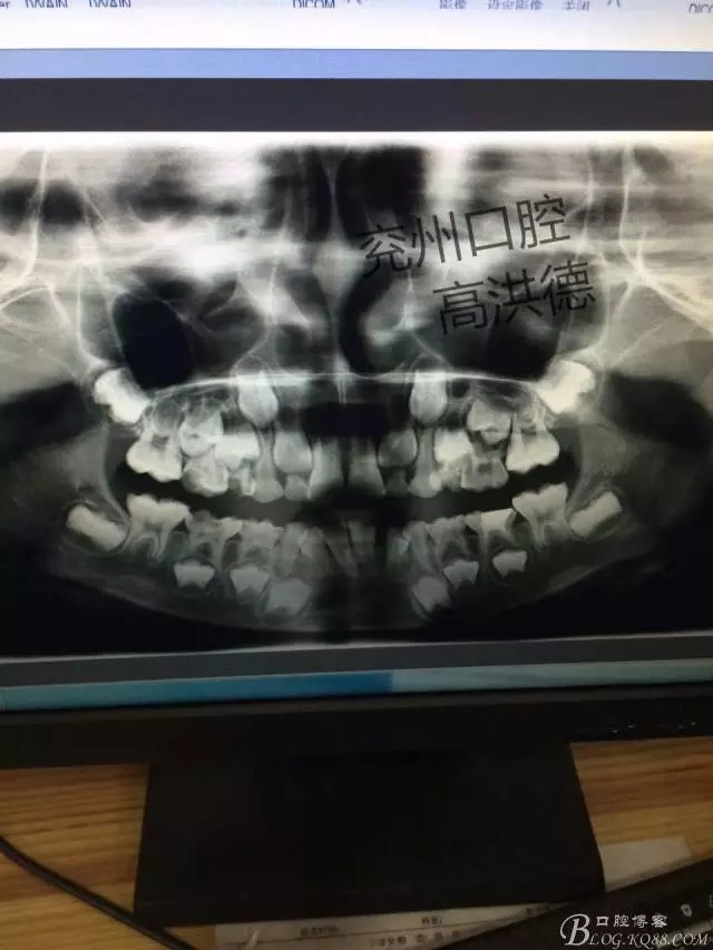 640.webp (1).jpg 640.webp (1).jpg