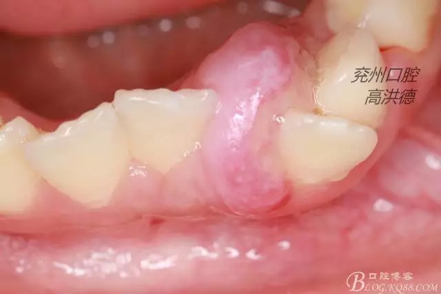 640.webp (4).jpg 640.webp (4).jpg