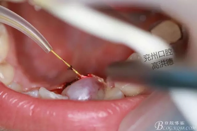 640.webp (10).jpg 640.webp (10).jpg