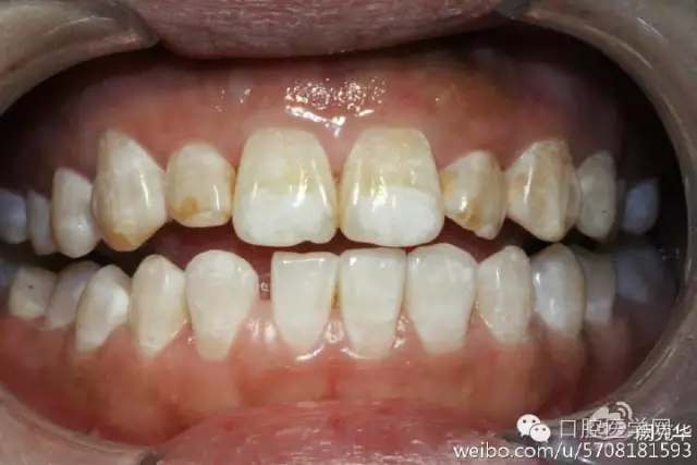 640.webp (1).jpg 640.webp (1).jpg