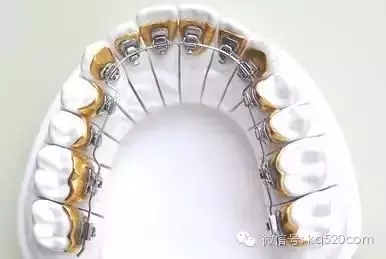 640.webp (4).jpg 640.webp (4).jpg