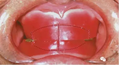 640.webp.jpg 640.webp.jpg