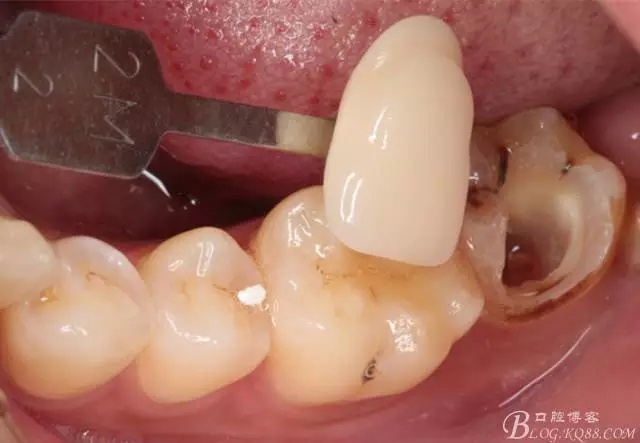 640.webp (4).jpg 640.webp (4).jpg