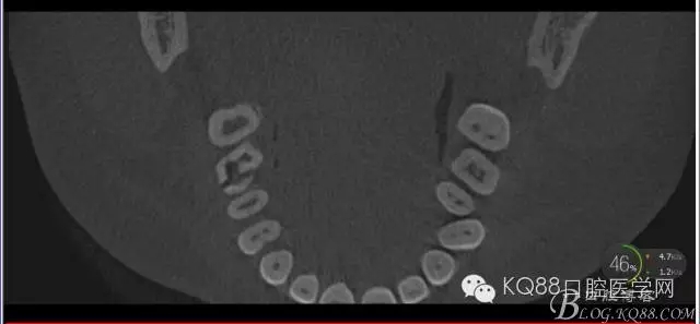 640.webp (2).jpg 640.webp (2).jpg