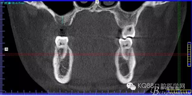 640.webp (4).jpg 640.webp (4).jpg