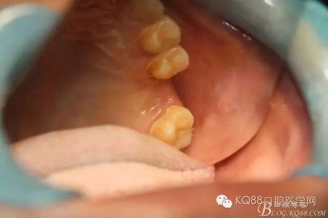 640.webp (5).jpg 640.webp (5).jpg